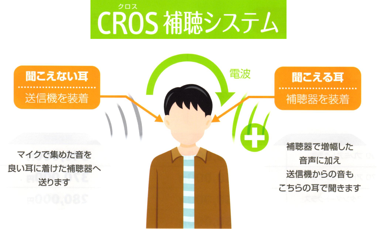 CROSS補聴システム